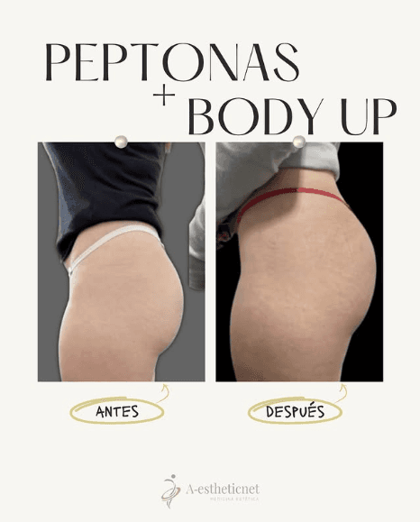 Peptonas + Body Go - antes y después